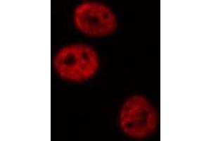 ABIN6277420 staining NIH-3T3 cells by IF/ICC. (PAWR anticorps  (C-Term))