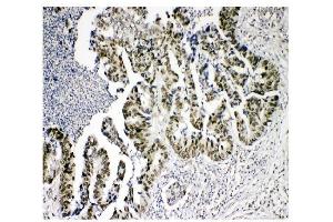 IHC analysis of KDM5B using anti-KDM5B antibody (ABIN4886648). (KDM5B anticorps  (Middle Region))