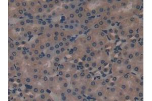Detection of MRP1 in Mouse Kidney Tissue using Polyclonal Antibody to Multidrug Resistance Associated Protein 1 (MRP1)
