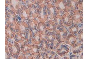 IHC-P analysis of Mouse Stomach Tissue, with DAB staining. (IL11RA anticorps  (AA 194-329))