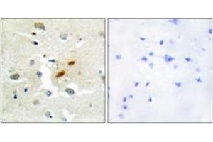 Immunohistochemistry (IHC) image for anti-REV3-Like, Polymerase (DNA Directed), Zeta, Catalytic Subunit (REV3L) (AA 231-280) antibody (ABIN2889337)