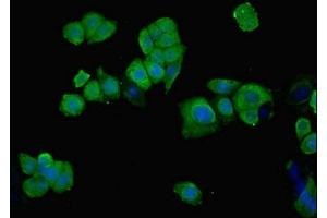 Immunofluorescent analysis of PC-3 cells using ABIN7149438 at dilution of 1:100 and Alexa Fluor 488-congugated AffiniPure Goat Anti-Rabbit IgG(H+L)