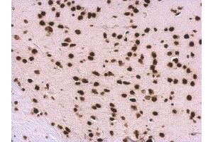 IHC-P Image SNRPA antibody detects SNRPA protein at nucleus on mouse fore brain by immunohistochemical analysis.