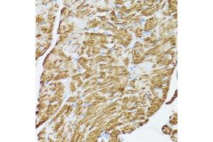 Immunohistochemistry of paraffin-embedded rat heart using CYCS antibody. (Cytochrome C anticorps  (AA 1-105))