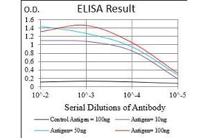 Black line: Control Antigen (100 ng), Purple line: Antigen(10 ng), Blue line: Antigen (50 ng), Red line: Antigen (100 ng), (CTNNBL1 anticorps  (AA 390-557))