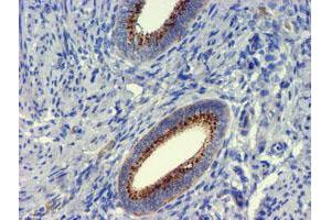 Image no. 3 for anti-Golgi Membrane Protein 1 (GOLM1) antibody (ABIN1498494) (GOLM1 anticorps)