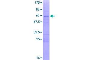 Image no. 1 for Synovial Sarcoma, X Breakpoint 5 (SSX5) (AA 1-229) protein (GST tag) (ABIN1321465)