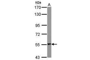 Image no. 2 for anti-Aspartyl-tRNA Synthetase (DARS) (AA 304-501) antibody (ABIN1497768) (DARS anticorps  (AA 304-501))