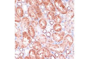 Immunohistochemistry of paraffin-embedded rat kidney using VASP antibody (ABIN6134453, ABIN6150064, ABIN6150065 and ABIN6218508) at dilution of 1:100 (40x lens). (VASP anticorps  (AA 1-100))