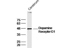Mouse cerebrum lysates probed with DRD1 Polyclonal Antibody, unconjugated  at 1:300 overnight at 4°C followed by a conjugated secondary antibody at 1:10000 for 90 minutes at 37°C.
