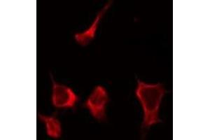 ABIN6268837 staining HepG2 by IF/ICC. (Galectin 9 anticorps  (Internal Region))