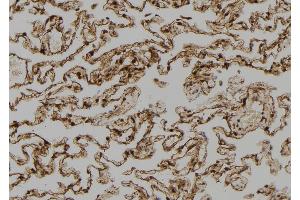 ABIN6273390 at 1/100 staining Human lung tissue by IHC-P. (SH3BP2 anticorps  (Internal Region))