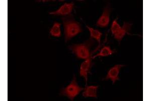 ABIN6269040 staining HeLa by IF/ICC. (SGK1 anticorps  (C-Term))