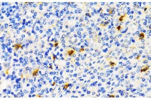 Immunohistochemistry of paraffin-embedded Human tonsil using TIM-3/HAVCR2 Polyclonal Antibody at dilution of 1:200 (40x lens). (TIM3 anticorps)