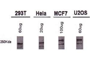 Western blot analysis of BRCA1 using BRCA1 monoclonal antibody, clone MU . (BRCA1 anticorps  (AA 1314-1864))