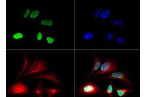 Immunofluorescence of Histone H3 [monomethyl Lys79-Me1]: Histone H3 K79me1 antibody was tested in Hela cells with DyLight 488 (green).