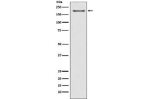 Western blot analysis of NSD3 expression in MCF-7 cell lysate.