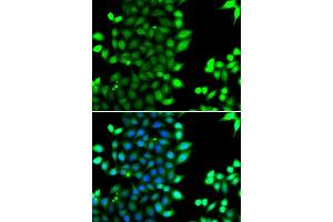 Immunofluorescence analysis of MCF7 cell using RNF7 antibody. (RNF7 anticorps)