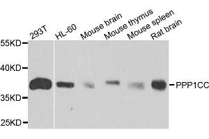 Western blot analysis of extracts of various cell lines, using PPP1CC antibody. (PPP1CC anticorps  (AA 1-323))