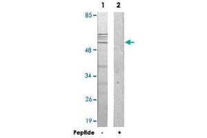 Western blot analysis of extracts from 293 cells, using IP6K3 polyclonal antibody . (IP6K3 anticorps)