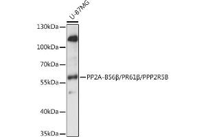 Western blot analysis of extracts of U-87MG cells, using PP2A-B56β/PR61β/PP2A-B56β/PR61β/PPP2R5B antibody (ABIN7269689) at 1:1000 dilution.