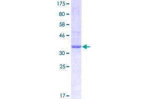 Image no. 1 for Protease, Serine, 21 (Testisin) (PRSS21) (AA 121-220) protein (GST tag) (ABIN1316475)