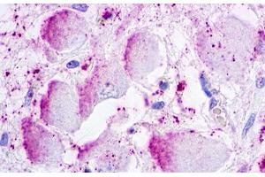 Image no. 1 for anti-G Protein-Coupled Receptor 26 (GPR26) (Extracellular Domain) antibody (ABIN1048785) (GPR26 anticorps  (Extracellular Domain))