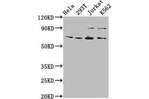 Western Blot Positive WB detected in: Hela whole cell lysate, 293T whole cell lysate, Jurkat whole cell lysate, K562 whole cell lysate All lanes: ALG9 antibody at 6. (ALG9 anticorps  (AA 434-618))
