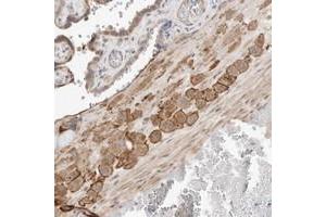 Immunohistochemical staining of human placenta with FLJ43582 polyclonal antibody  shows strong membranous and cytoplasmic positivity in decidual cells at 1:20-1:50 dilution. (C8ORF86 anticorps)