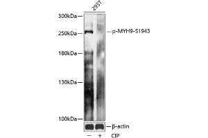Western blot analysis of extracts of 293T cells, using Phospho-MYH9-S1943 antibody (ABIN7268744) at 1:2000 dilution.
