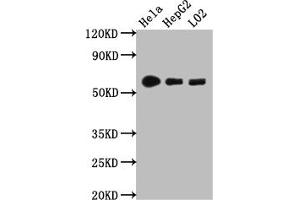 Western Blot Positive WB detected in: Hela whole cell lysate, HepG2 whole cell lysate, L02 whole cell lysate All lanes: CYP1A2 antibody at 1:1000 Secondary Goat polyclonal to rabbit IgG at 1/50000 dilution Predicted band size: 59 kDa Observed band size: 59 kDa