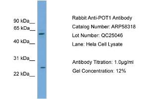 WB Suggested Anti-POT1  Antibody Titration: 0. (POT1 anticorps  (Middle Region))