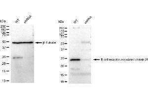 anti-B-Cell Receptor-Associated Protein 31 (BCAP31) antibody