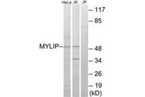 Western blot analysis of extracts from HeLa/Jurkat cells, using MYLIP Antibody. (MYLIP anticorps  (AA 161-210))