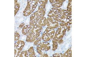 Immunohistochemistry of paraffin-embedded mouse kidney using PLS1 antibody (ABIN7269391) at dilution of 1:100 (40x lens).