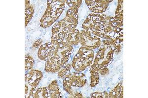Immunohistochemistry of paraffin-embedded mouse kidney using PLS1 antibody (ABIN7269391) at dilution of 1:100 (40x lens). (PLS1 anticorps  (AA 1-110))