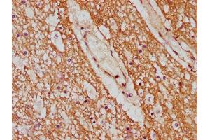 IHC image of ABIN7142186 diluted at 1:600 and staining in paraffin-embedded human brain tissue performed on a Leica BondTM system.