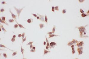 Anti-Hsp90-alpha-Picoband antibody,  ICC: A549 Cell