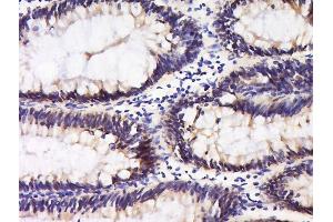 paraformaldehyde-fixed, paraffin embedded mouse placenta tissue, Antigen retrieval by boiling in sodium citrate buffer(pH6) for 15min, Block endogenous peroxidase by 3% hydrogen peroxide for 30 minutes, Blocking buffer (normal goat serum) at 37°C for 20min, Antibody incubation with Rabbit Anti-Integrin alpha 5 Polyclonal Antibody, Unconjugated  at 1:400 overnight at 4°C, followed by a conjugated secondary and DAB staining