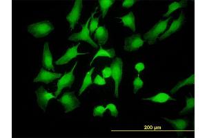 Immunofluorescence of monoclonal antibody to PBK on HeLa cell. (PBK anticorps  (AA 1-110))