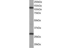 Image no. 1 for anti-Importin 7 (IPO7) (C-Term) antibody (ABIN374249) (IPO7 anticorps  (C-Term))