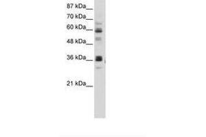 Image no. 2 for anti-RNA Pseudouridylate Synthase Domain Containing 2 (RPUSD2) (AA 201-250) antibody (ABIN202743) (RPUSD2 anticorps  (AA 201-250))
