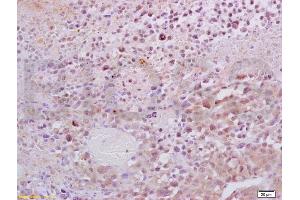 Formalin-fixed and paraffin embedded mouse lymphoma tissue labeled with Anti-Dnmt1 Polyclonal Antibody, Unconjugated (ABIN671796) at 1:200, followed by conjugation to the secondary antibody and DAB staining (DNMT1 anticorps  (AA 21-120))