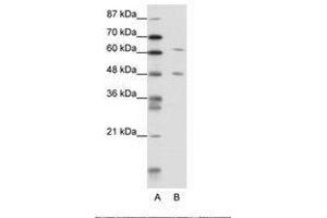 Image no. 1 for anti-NGFI-A Binding Protein 2 (EGR1 Binding Protein 2) (NAB2) (N-Term) antibody (ABIN202715) (NAB2 anticorps  (N-Term))