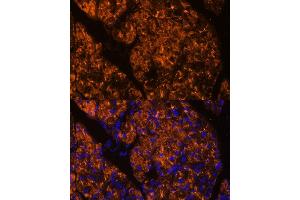 Immunofluorescence analysis of rat pancreas using SERPINI2 Polyclonal Antibody (ABIN6131321, ABIN6147617, ABIN6147618 and ABIN6215429) at dilution of 1:100 (40x lens).