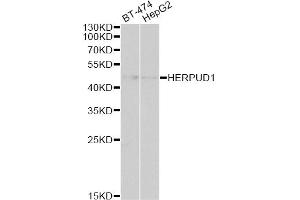 Western blot analysis of extracts of various cell lines, using HERPUD1 antibody. (HERPUD1 anticorps)