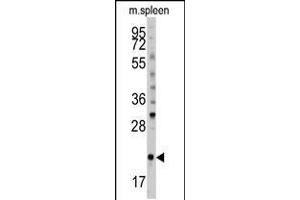 Western blot analysis of (S61) in mouse spleen tissue lysates (35ug/lane) (BID anticorps  (AA 39-68))