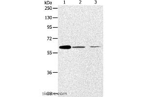 Western blot analysis of NIH/3T3 and SKOV3 cell, human ovarian cancer tissue, using ABCE1 Polyclonal Antibody at dilution of 1:450 (ABCE1 anticorps)