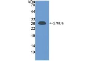 Detection of Recombinant PRL, Human using Polyclonal Antibody to Prolactin (PRL)
