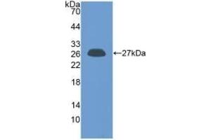 Detection of Recombinant PRL, Human using Polyclonal Antibody to Prolactin (PRL) (Prolactin anticorps  (AA 29-227))